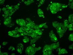 MAP2K4 Mouse anti-Canine, Human, Clone: OTI8A8, lyophilized, TrueMAB 100