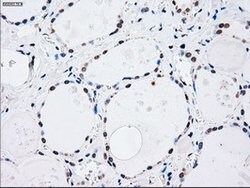 MAP2K4 Mouse anti-Canine, Human, Clone: OTI8A8, lyophilized, TrueMAB 100