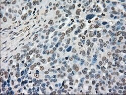 MAP2K4 Mouse anti-Human, Clone: OTI2D5, liquid, TrueMAB 100 &mu;L; Unconjugated:Antibodies,
