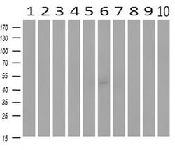 MAP2K4 Mouse anti-Canine, Human, Clone: OTI8A8, lyophilized, TrueMAB 100