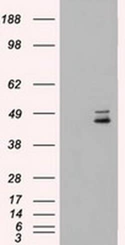 MAP2K4 Mouse anti-Human, Clone: OTI2D5, liquid, TrueMAB 100 &mu;L; Unconjugated:Antibodies,