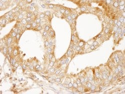 MAP4 Polyclonal Antibody, Bethyl Laboratories 10 &mu;L; Unconjugated:Antibodies,