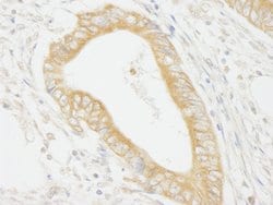 MAP4K4/HGK Polyclonal Antibody, Bethyl Laboratories 100 &mu;l; Unlabeled:Antibodies,