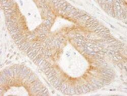 MAP7 Rabbit anti-Human, Polyclonal, Bethyl Laboratories 10 &mu;l; Unlabeled:Antibodies,