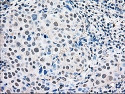 MAPK1 Mouse anti-Canine, Human, Rat, Clone: OTI6F8, lyophilized, TrueMAB