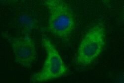 MAPK13 Mouse anti-Human, Clone: OTI12C6, lyophilized, TrueMAB 100 &mu;g;