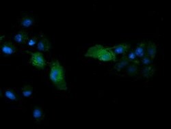 MAPK13 Mouse anti-Human, Clone: OTI2A10, lyophilized, TrueMAB 100 &mu;g;