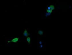MAPK13 Monoclonal Antibody (OTI12B2), TrueMAB , OriGene 100 &mu;L; Unconjugated:Antibodies,
