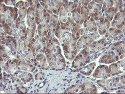 MAPK13 Monoclonal Antibody (OTI12C3), TrueMAB , OriGene 100 &mu;L; Unconjugated:Antibodies,
