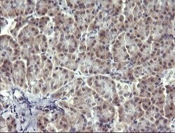 MAPK13 Mouse anti-Human, Clone: OTI2A10, lyophilized, TrueMAB 100 &mu;g;