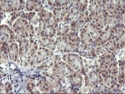 MAPK13 Monoclonal Antibody (OTI2A10), TrueMAB , OriGene 100 &mu;L; Unconjugated:Antibodies,