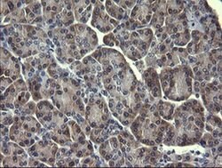 MAPK13 Monoclonal Antibody (OTI12B2), TrueMAB , OriGene 100 &mu;L; Unconjugated:Antibodies,