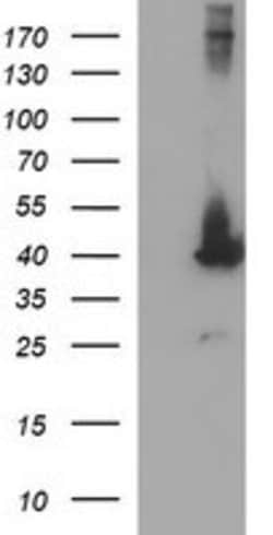 MAPK13 Mouse anti-Human, Clone: OTI12C6, lyophilized, TrueMAB 100 &mu;g;
