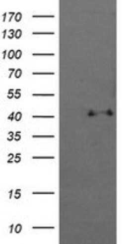 MAPK13 Mouse anti-Canine, Human, Mouse, Clone: OTI12B12, lyophilized, TrueMAB 100 &mu;g | Buy Online | Origene Technologies | Fisher Scientific