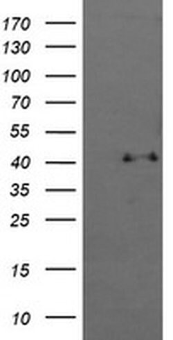 MAPK13 Monoclonal Antibody (OTI12B12), TrueMAB , OriGene 100 &mu;L; Unconjugated:Antibodies,