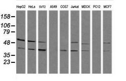 MAPK13 Mouse anti-Canine, Human, Mouse, Clone: OTI12B12, lyophilized, TrueMAB 100 &mu;g | Buy Online | Origene Technologies | Fisher Scientific