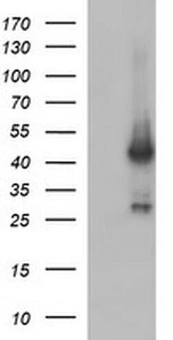 MAPK13 Monoclonal Antibody (OTI12D2), TrueMAB , OriGene 100 &mu;L; Unconjugated:Antibodies,