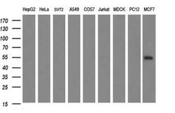 MAPK13 Mouse anti-Human, Clone: OTI12D2, lyophilized, TrueMAB 100 &mu;g;