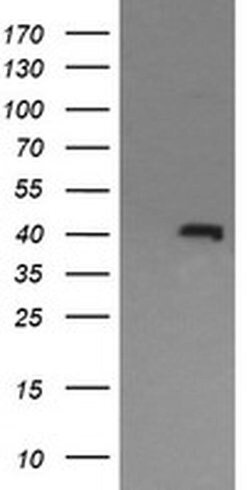 MAPK13 Monoclonal Antibody (OTI12E2), TrueMAB , OriGene:Antibodies:Primary