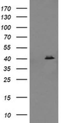 MAPK13 Monoclonal Antibody (OTI1H3), TrueMAB , OriGene 100 &mu;L; Unconjugated:Antibodies,