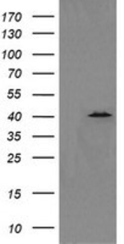 MAPK13 Mouse anti-Human, Clone: OTI2D1, lyophilized, TrueMAB 100 &mu;g;