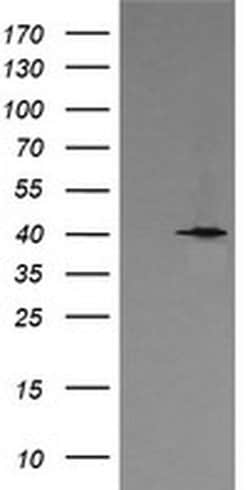 MAPK13 Monoclonal Antibody (OTI2F1), TrueMAB , OriGene 100 &mu;L; Unconjugated:Antibodies,