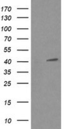 MAPK13 Mouse anti-Human, Clone: OTI2A10, lyophilized, TrueMAB 100 &mu;g;