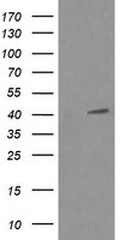 MAPK13 Monoclonal Antibody (OTI2A10), TrueMAB , OriGene:Antibodies:Primary