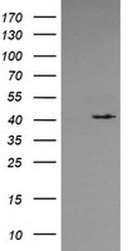 MAPK13 Monoclonal Antibody (OTI2G6), TrueMAB , OriGene:Antibodies:Primary