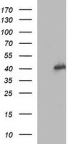 MAPK13 Mouse anti-Human, Clone: OTI2C7, lyophilized, TrueMAB 100 &mu;g;