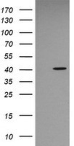 MAPK13 Mouse anti-Human, Clone: OTI2G5, lyophilized, TrueMAB 100 &mu;g | Buy Online | Origene Technologies | Fisher Scientific