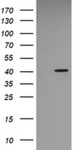 MAPK13 Monoclonal Antibody (OTI2G5), TrueMAB , OriGene 100 &mu;L; Unconjugated:Antibodies,