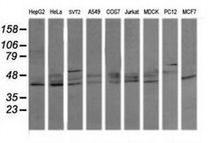 MAPK13 Monoclonal Antibody (OTI12B2), TrueMAB , OriGene 100 &mu;L; Unconjugated:Antibodies,