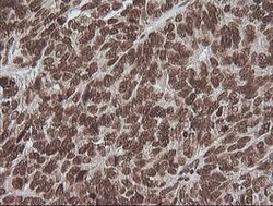 MAPK3 Mouse anti-Canine, Human, Clone: OTI4D7, lyophilized, TrueMAB 100