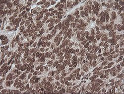 MAPK3 Monoclonal Antibody (OTI4D7), TrueMAB , OriGene 100 &mu;L; Unconjugated:Antibodies,