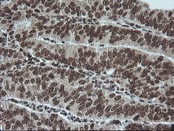 MAPK3 Monoclonal Antibody (OTI4D7), TrueMAB , OriGene 100 &mu;L; Unconjugated:Antibodies,