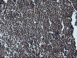 MAPK3 Monoclonal Antibody (OTI4D7), TrueMAB , OriGene 100 &mu;L; Unconjugated:Antibodies,