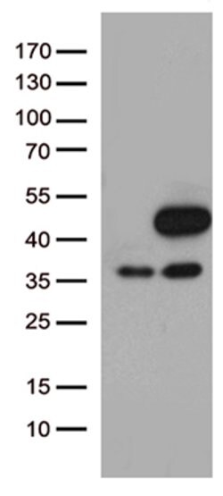 MAPK3 Mouse anti-Canine, Human, Clone: OTI4D7, lyophilized, TrueMAB 100