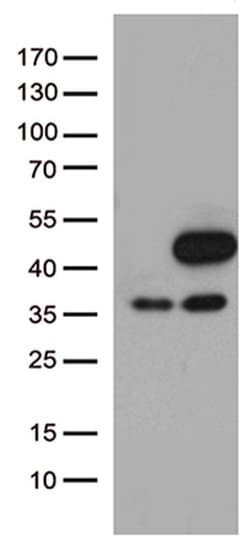 MAPK3 Monoclonal Antibody (OTI4D7), TrueMAB , OriGene 100 &mu;L; Unconjugated:Antibodies,