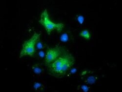 MAPK7 Monoclonal Antibody (OTI2E2), TrueMAB , OriGene 100 &mu;L; Unconjugated:Antibodies,