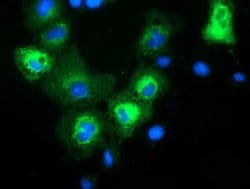 MAPK7 Monoclonal Antibody (OTI5B9), TrueMAB , OriGene 100 &mu;L; Unconjugated:Antibodies,