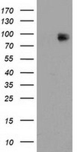 MAPK7 Monoclonal Antibody (OTI2E2), TrueMAB , OriGene 100 &mu;L; Unconjugated:Antibodies,