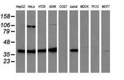 MAPK7 Mouse anti-Human, Clone: OTI4C1, lyophilized, TrueMAB 100 &mu;g;