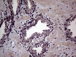 MAPK8IP1 Monoclonal Antibody (OTI1D9), TrueMAB , OriGene 100 &mu;L; Unconjugated:Antibodies,
