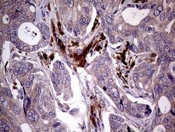 MAPK8IP1 Monoclonal Antibody (OTI1D9), TrueMAB , OriGene 100 &mu;L; Unconjugated:Antibodies,