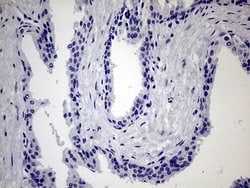 MAPK8IP1 Monoclonal Antibody (OTI1D9), TrueMAB , OriGene 100 &mu;L; Unconjugated:Antibodies,