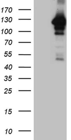 MAPK8IP1 Monoclonal Antibody (OTI3A12), TrueMAB , OriGene:Antibodies:Primary