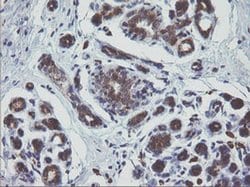 MAPK9 Monoclonal Antibody (OTI2H3), TrueMAB , OriGene 100 &mu;L; Unconjugated:Antibodies,