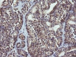MAPK9 Monoclonal Antibody (OTI2H3), TrueMAB , OriGene 100 &mu;L; Unconjugated:Antibodies,