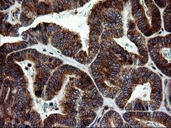 MAPK9 Mouse anti-Human, Clone: OTI2H3, lyophilized, TrueMAB 100 &mu;g;